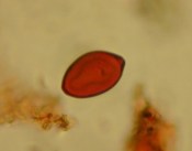Pictures of dung fungal spores as observed during palaeoecological investigations. Both spores are about 20 µm in length and require light microscope high magnification for identification and counting. ©A. Baker.
