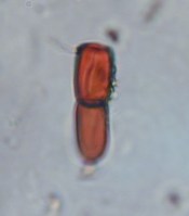 Pictures of dung fungal spores as observed during palaeoecological investigations. Both spores are about 20 µm in length and require light microscope high magnification for identification and counting. ©A. Baker.