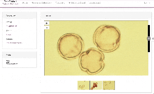 A digitised slide of Rheum rhabarbarum, collected from Mongolia in 2004.