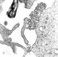 A TEM micrograph showing Dengue virus virions